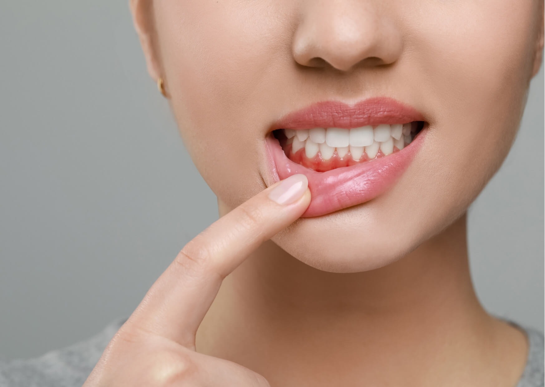 Close-up of swollen gums near a tooth, illustrating symptoms that may require dental abscess self care and professional treatment