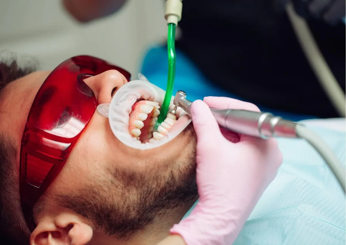 Dental professional removing plaque from a patient’s teeth during a professional cleaning.